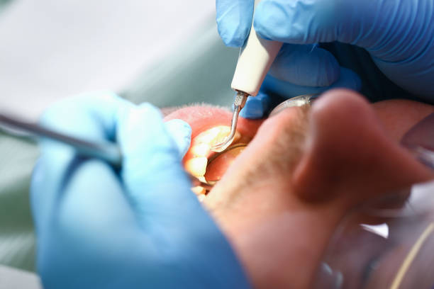 Best Emergency Treatment for Dental Infections or Abscesses in Dearborn Heights, MI