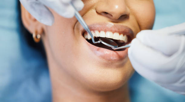 Best Urgent Care for Lost Fillings or Crowns in Dearborn Heights, MI